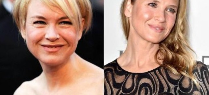 zellweger_3