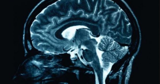 Se le conosci, le eviti: ecco le trappole che ci tende la nostra mente quando cerchiamo una casa da acquistare
