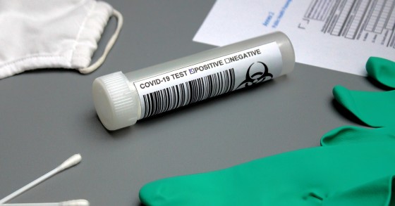 Tampone rapido gratuito, dove effettuare il test messo a disposizione dalla Croce Rossa