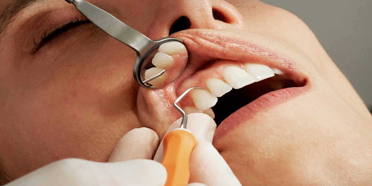 Bonus dentista 2025 Paziente durante la cura dentale