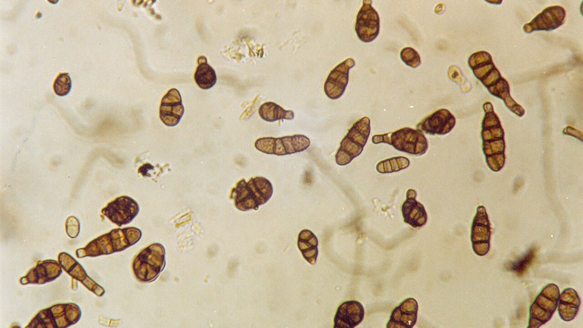 alternaria