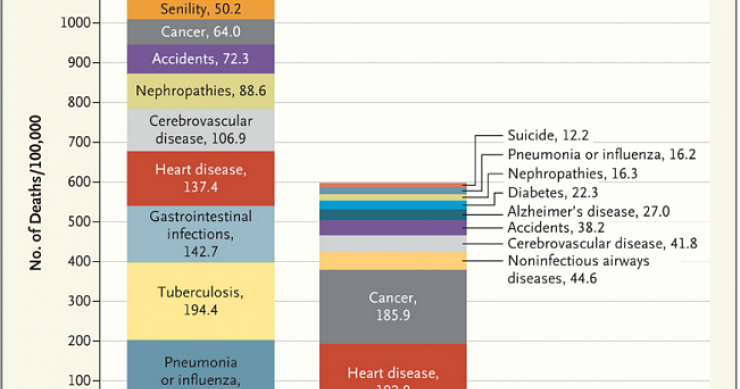 Immagine del giorno: come sono cambiate le cause di morte in cento anni